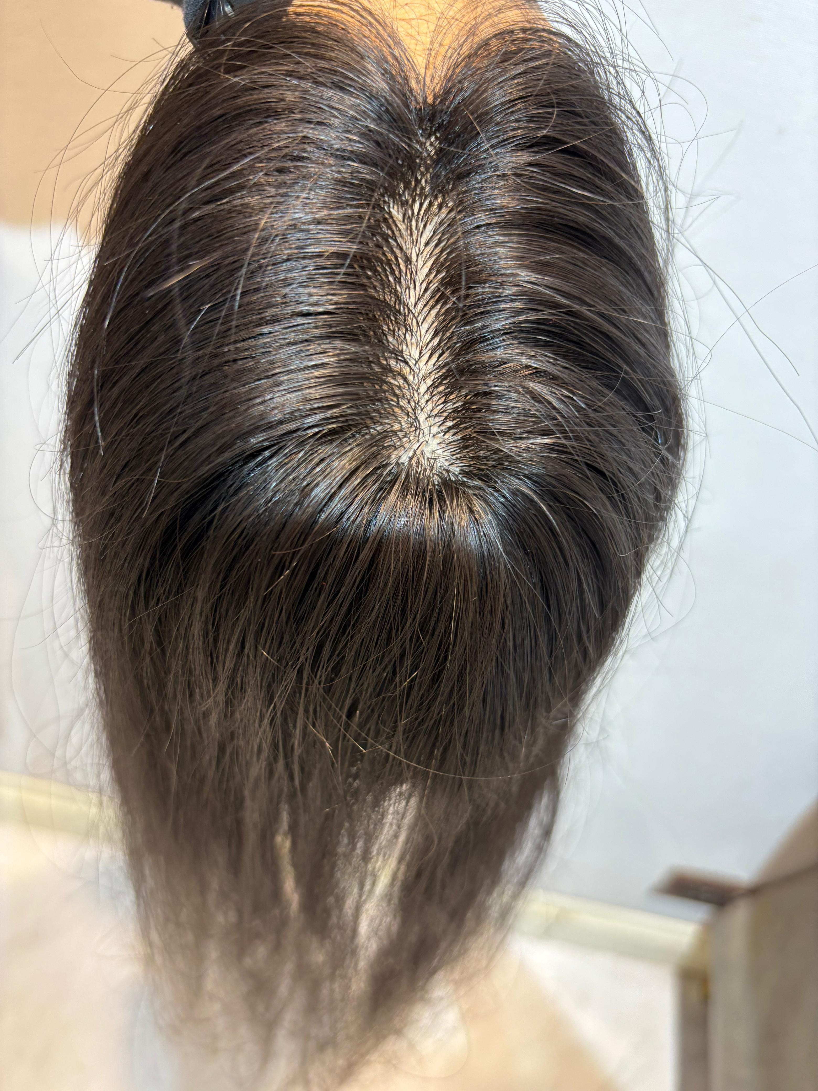 Hair Topper for Postpartum Hair Loss | Silk Base | Natural Black | Straight | Remy Hair India-1
